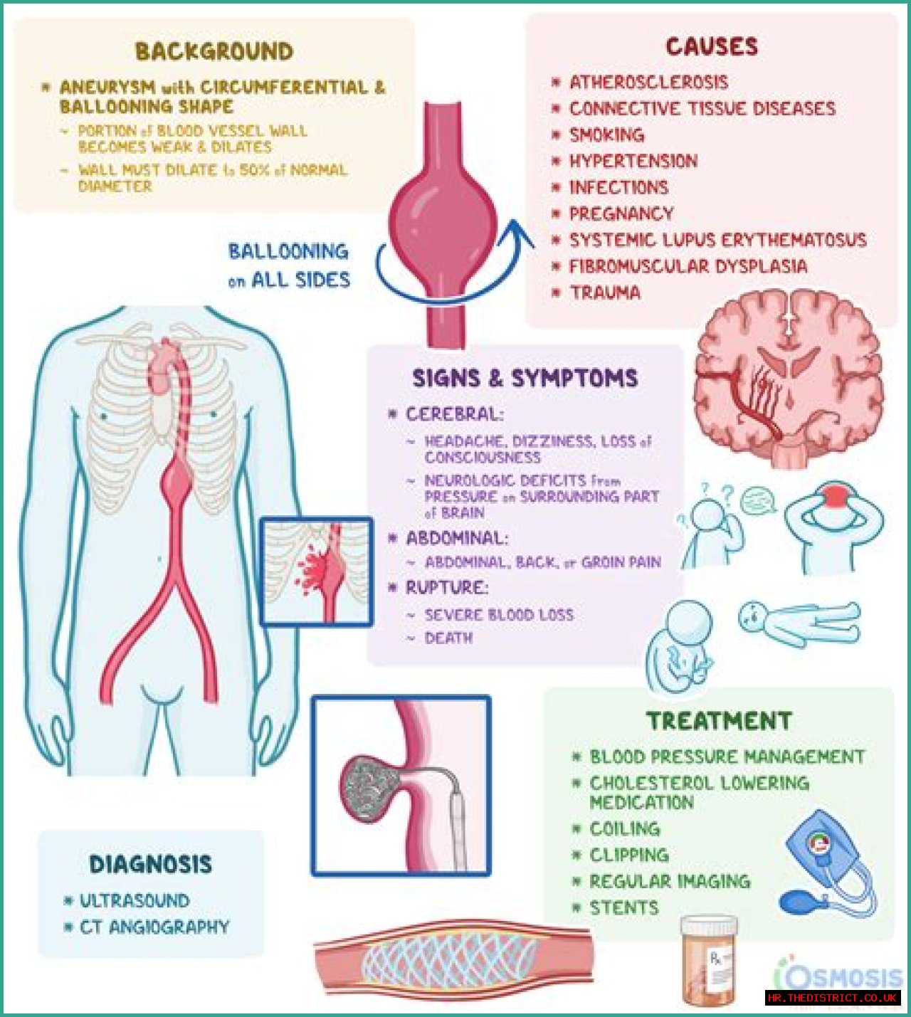 Understanding Hasbulla Disease: Causes, Symptoms, And Treatment